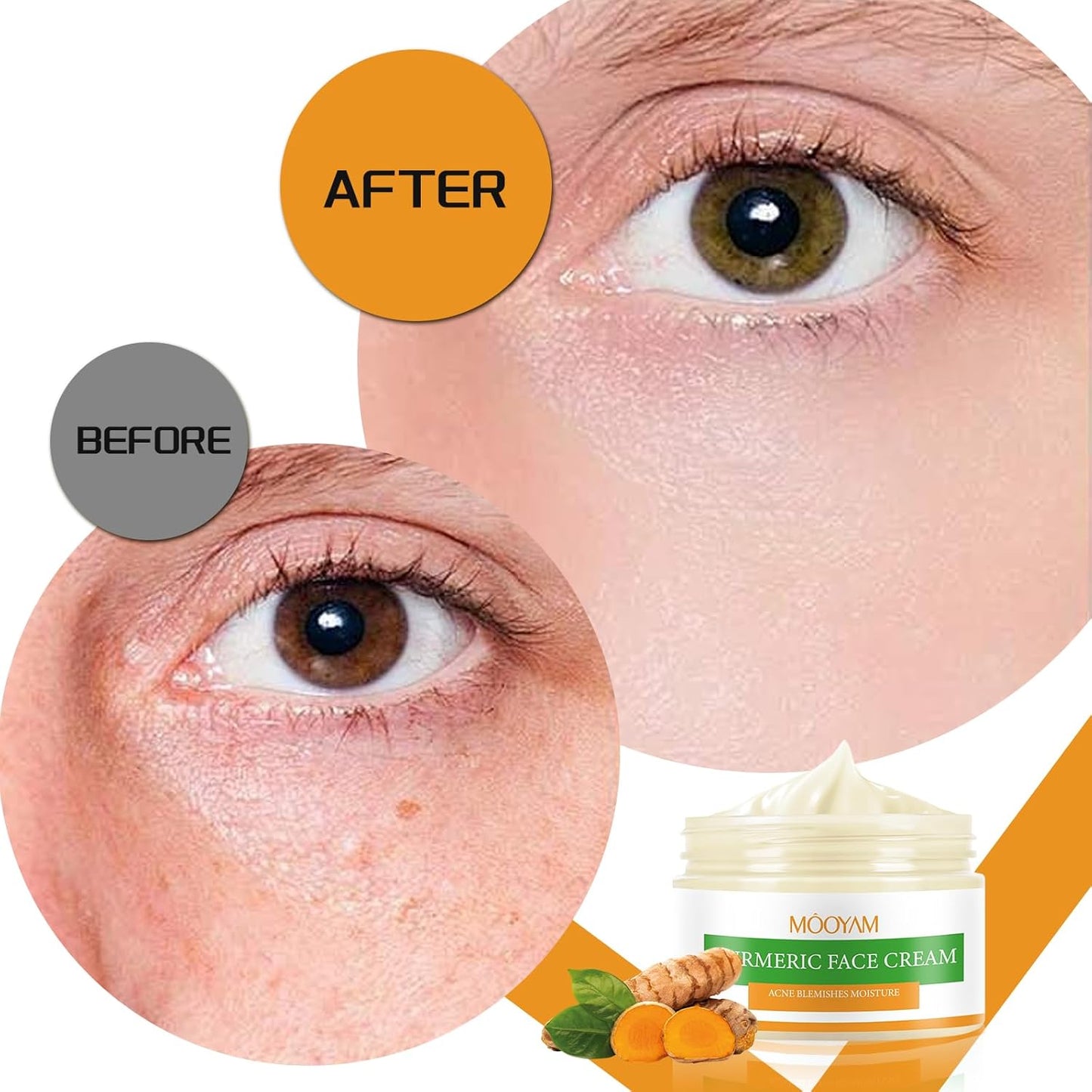 Revitalize Your Skin: Organic Turmeric Face Cream for Acne Spots & Blemishes - Perfect Christmas Gift (50G)